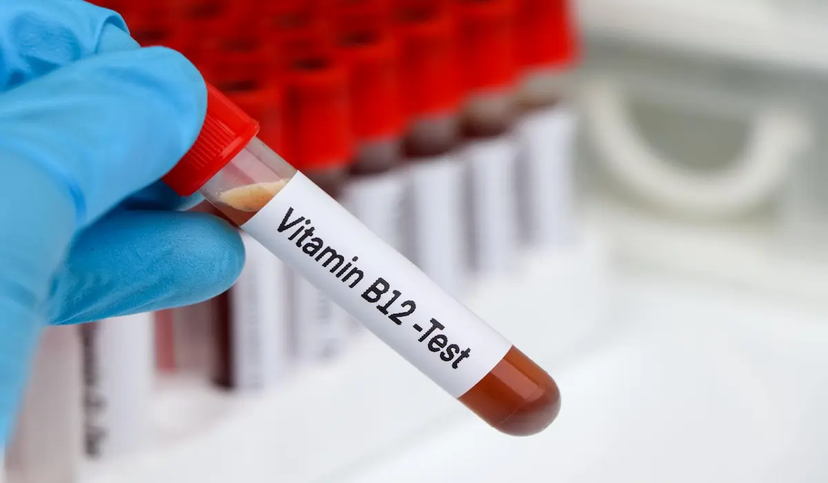 Vitamin B12